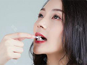 日志—牙齿矫正：看我牙齿神奇变化过程！
