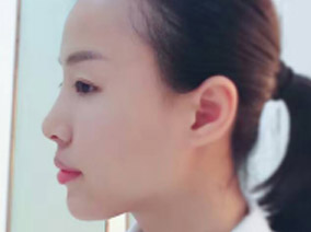 打“玻”全程直播 360°美给你看
